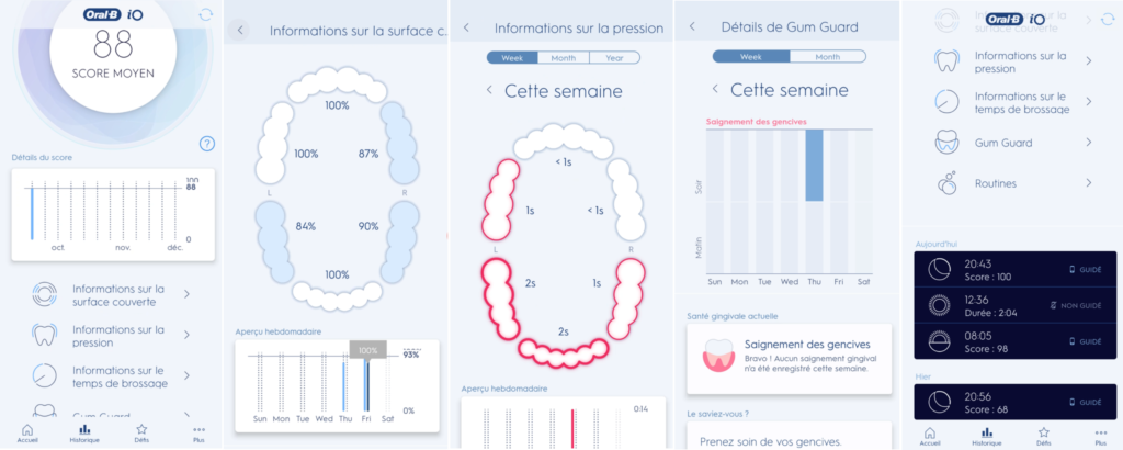 Les données de brossage de l'application Oral-B